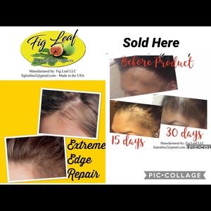 Don’t be embarrassed anymore with thinning hair..